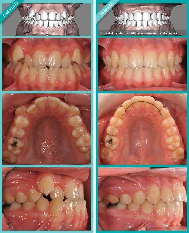 Ortodontski primer