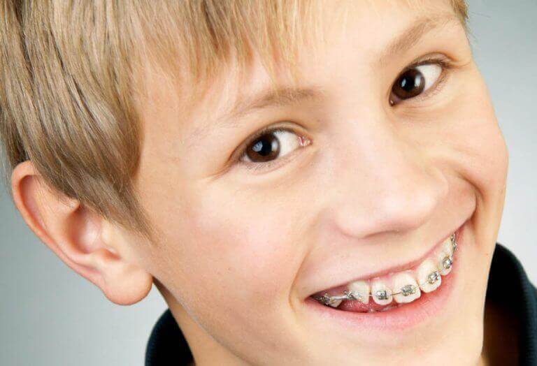 Ortodontija za otroke