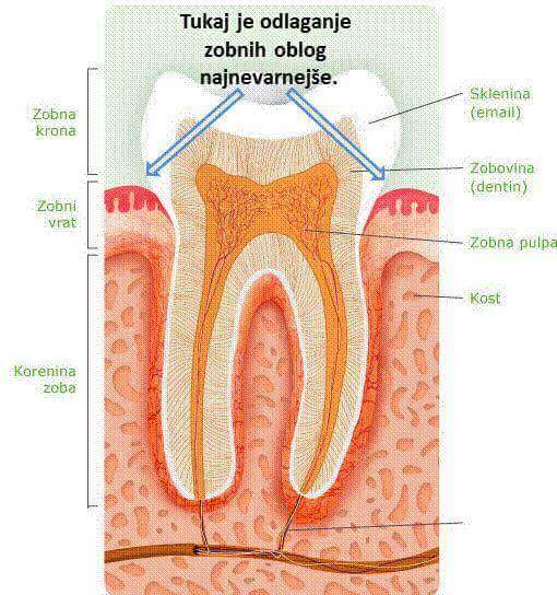 Slika prikazuje normalno anatomijo zoba in lokacije, ki jih moramo še posebej dobro očistiti.