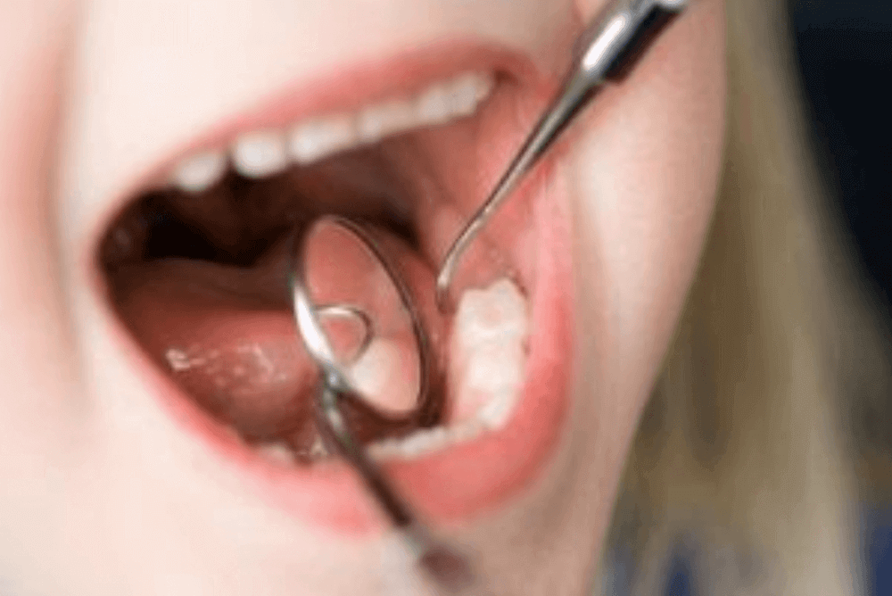 Zobozdravnik in otrok skupaj preštejeta zobke