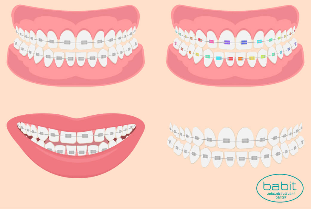 ortodontski primeri
