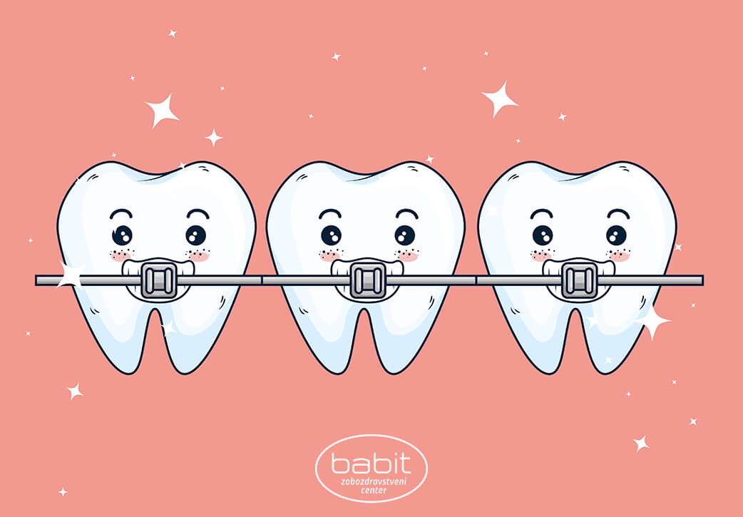 različice ortodontskih aparatov