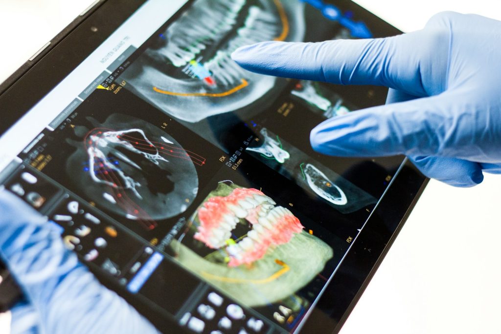 3D rentgen (CBCT) – kdaj ga potrebujemo?