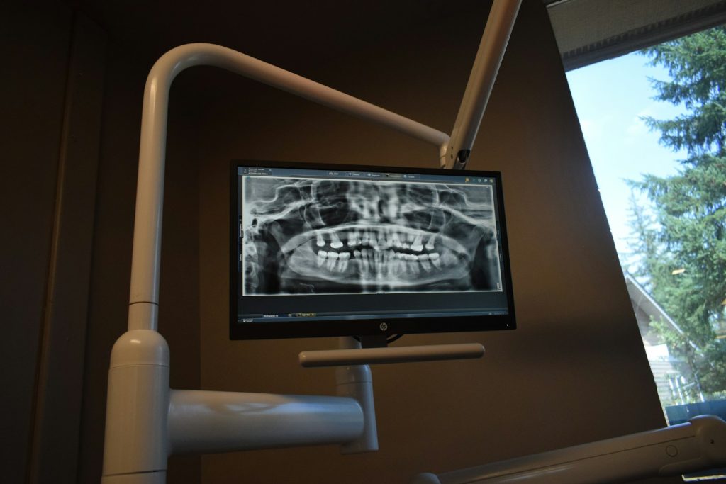 3D rentgen (CBCT) – kdaj ga potrebujemo? – fotografija